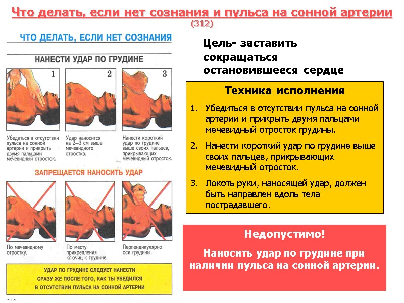 Что делать, если нет сознания и пульса на сонной артерии (312) Цель- заставить сокращаться